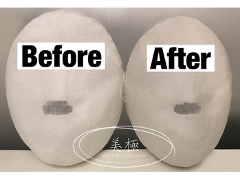 美極 トータルビューティー(美極 TOTAL BEAUTY)/恵比寿/小顔コルギ/エステ/