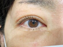 ルピナス(Lupinus)/アミノ酸ラッシュリフト