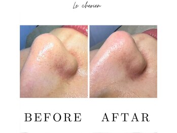 ルシェリア(Le cherien)/ハイドラフェイシャル