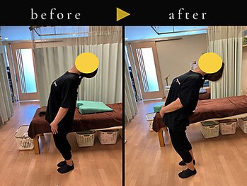 杉本接骨鍼灸院/背骨から全身がユルユル整体