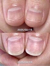 ポメロ(POMELO)/短期間でもこの変化が叶うのは