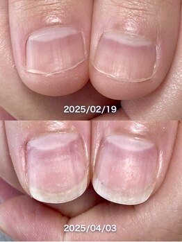 ポメロ(POMELO)/短期間でもこの変化が叶うのは