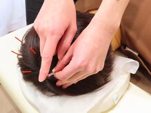 あろまはりきゅう 神楽坂