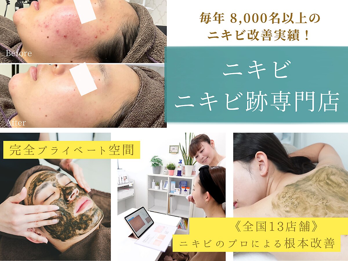 ニキビケア 毛穴研究所 立川店｜ホットペッパービューティー