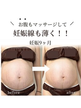 エメクルール 岐阜(AimerCouleur.)/妊婦専用！全身リンパマッサージ