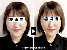 アオヤマ サロン ワイゼット(AOYAMA SALON YZ)の雰囲気（エラの張り・くいしばりの硬さ・むくみにアプローチしてVライン）