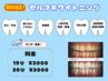【3月限定】セルフホワイトニング30分　3000円