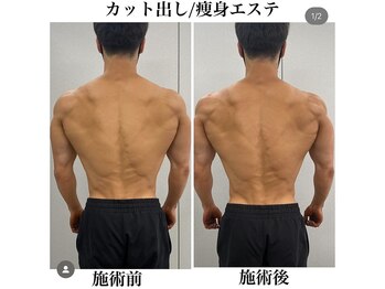 ヴィーナス(Venus)/スタッフ施術/上半身カット出し