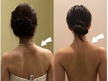 ラグラン銀座メディカルエステ 高輪ゲートウェイ店/＼ブライダル／プレ花嫁のお客様