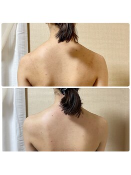 スリーピングビューティー(Sleeping Beauty)/インディバ　姿勢改善