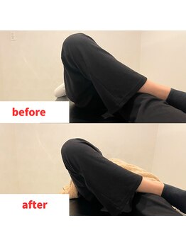 ナオル整体 福岡香椎院(NAORU整体)/20代女性施術事例【骨盤矯正】