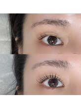 理想の二重へ近づける【ダブルアイリフト】☆