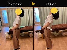 杉本接骨鍼灸院/背骨から全身がユルユル整体