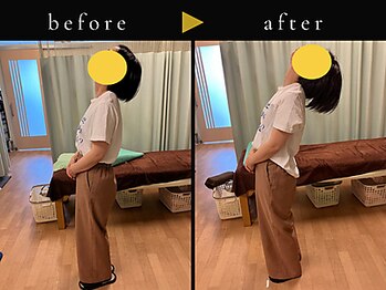 杉本接骨鍼灸院/背骨から全身がユルユル整体
