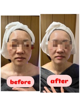 モコ(moco)/経絡フェイシャル♪