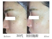 クレアルーチェ 名駅店(crealuce)の雰囲気（美容液で毛穴洗浄/汚れを取り除きながら、しっかり引き締める◎）