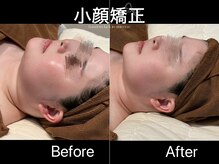 アイラブワン 大和 南林間店(eye love one)/小顔矯正【小顔/フェイシャル】