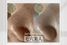 フェイシャルサロン アリイ(ALII)