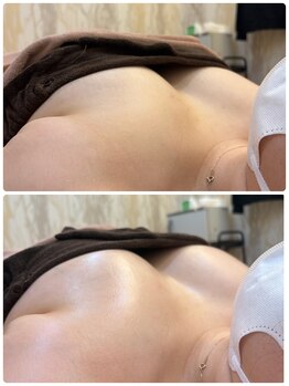 そらまめ/バストケア1回目です