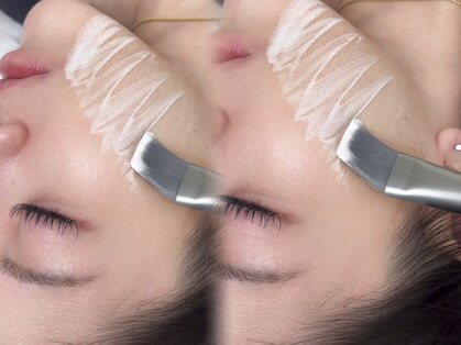 ソア(soa.)の写真