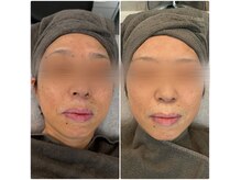 ジュエル(JEWELL)の雰囲気（【アンストレス】落ち着いた空間で叶える本気の肌質改善サロン）