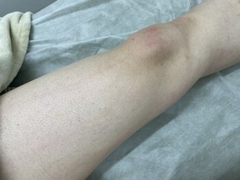 ナノハナ/鹿沼市の全身脱毛美容室ナノハナ