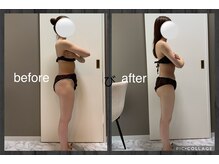 チャロアイト 可部店(Charoite)/下半身痩せ