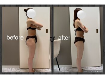 チャロアイト 可部店(Charoite)/下半身痩せ