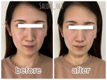 サロン オリ(salon_oli)/＼唯一無二の浮腫み取り／