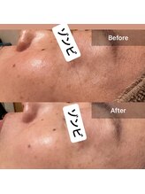 サロン ウイ(salon u'i)/～ゾンビ～