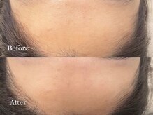 プレジール(plaisir)/生え際ラインも綺麗に♪