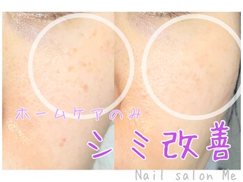 ミー(Me)/《肌質改善》