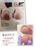 巻き爪ケア1本3000円！