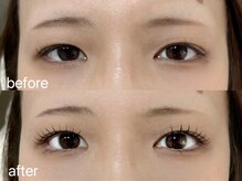 プール エドボリ(POOL EDOBORI)/◇&healtyアンドヘルシー120本