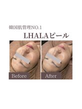 フォルディオ(FORDIO)/ララピール[札幌/円山]