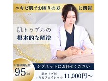 シグネット(Cygnet)