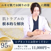 シグネット(Cygnet)