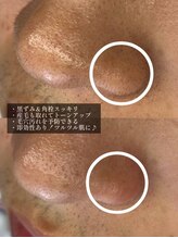 アイビー 長崎店(+i.b)/小鼻ワックス