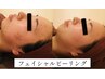 【繰り返すニキビに】なめらかな素肌へ♪フェイシャルピーリング　　￥14300→