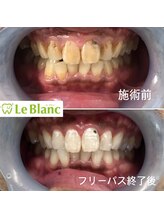 ルブラン 奈良店(Le Blanc)/3週間で変わる！