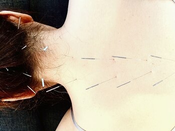 むらかみ鍼灸 マッサージ/