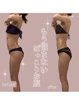 ソワン(Soin)/30代　中半身