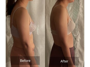 ハートランド(HEARTLAND)/6kg痩せてもお胸は削げさせない