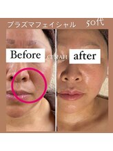 リラクゼーションルーム チュラ(Relaxation Room CERAH)/