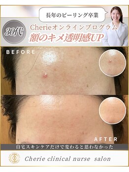 シェリー(Cherie)/皮膚の乾燥・キメ改善！透明感UP