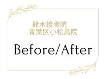 鈴木接骨院 青葉区小松島院/施術のBefore/After写真