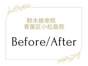 鈴木接骨院 青葉区小松島院/施術のBefore/After写真