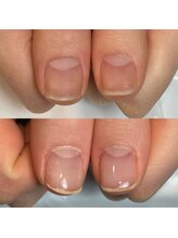 キュア(Cure.)/自爪育成を成功させる自爪育成