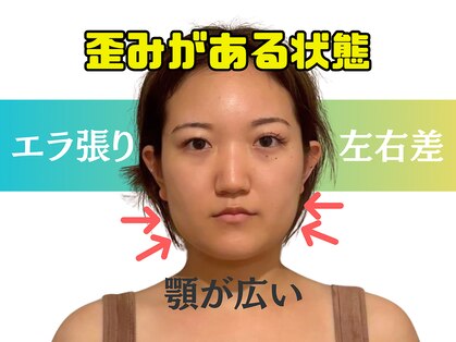 ミライ小顔 溝の口店(MIRAI小顔)の写真