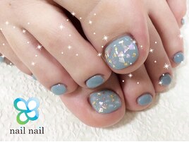 足の深爪でお悩みの方★アフター